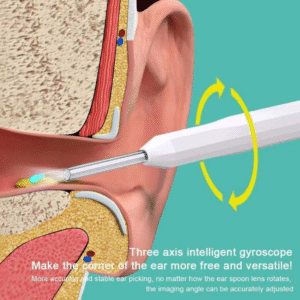Wireless Visual Earpick || āĻā§ā§āϝāĻžāϰāϞā§āϏ āĻāĻŋāĻā§āϝā§āϝāĻŧāĻžāϞ āĻāϝāĻŧāĻžāϰāĻĒāĻŋāĻ